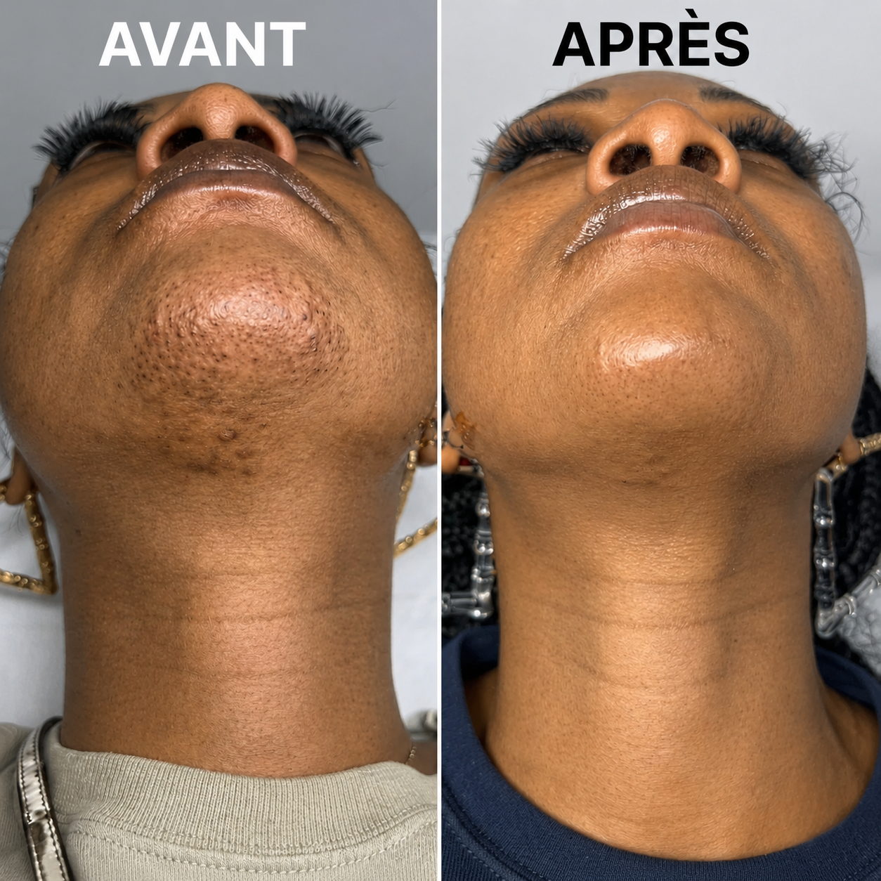Stop Repousse Végétal
