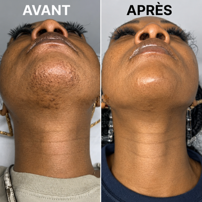 Stop Repousse Végétal